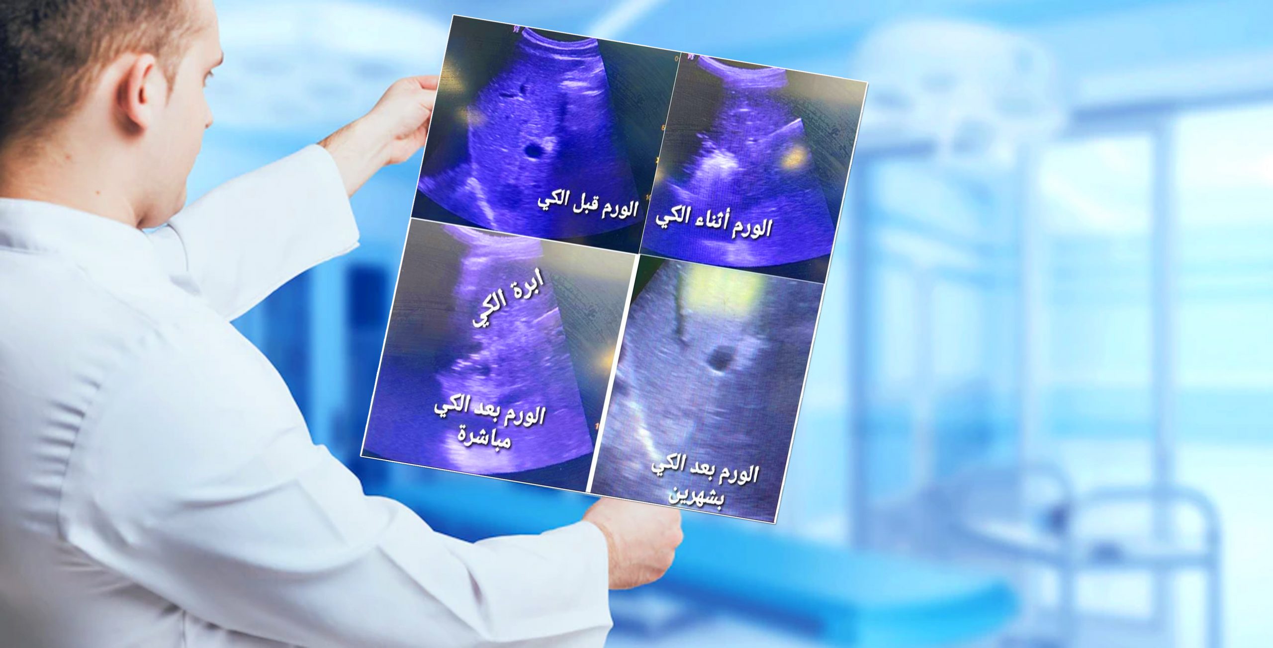 إضافة تقنيات جديدة ومتطورة بوحدة الأشعة التداخلية بمستشفي سوهاج الجامعي